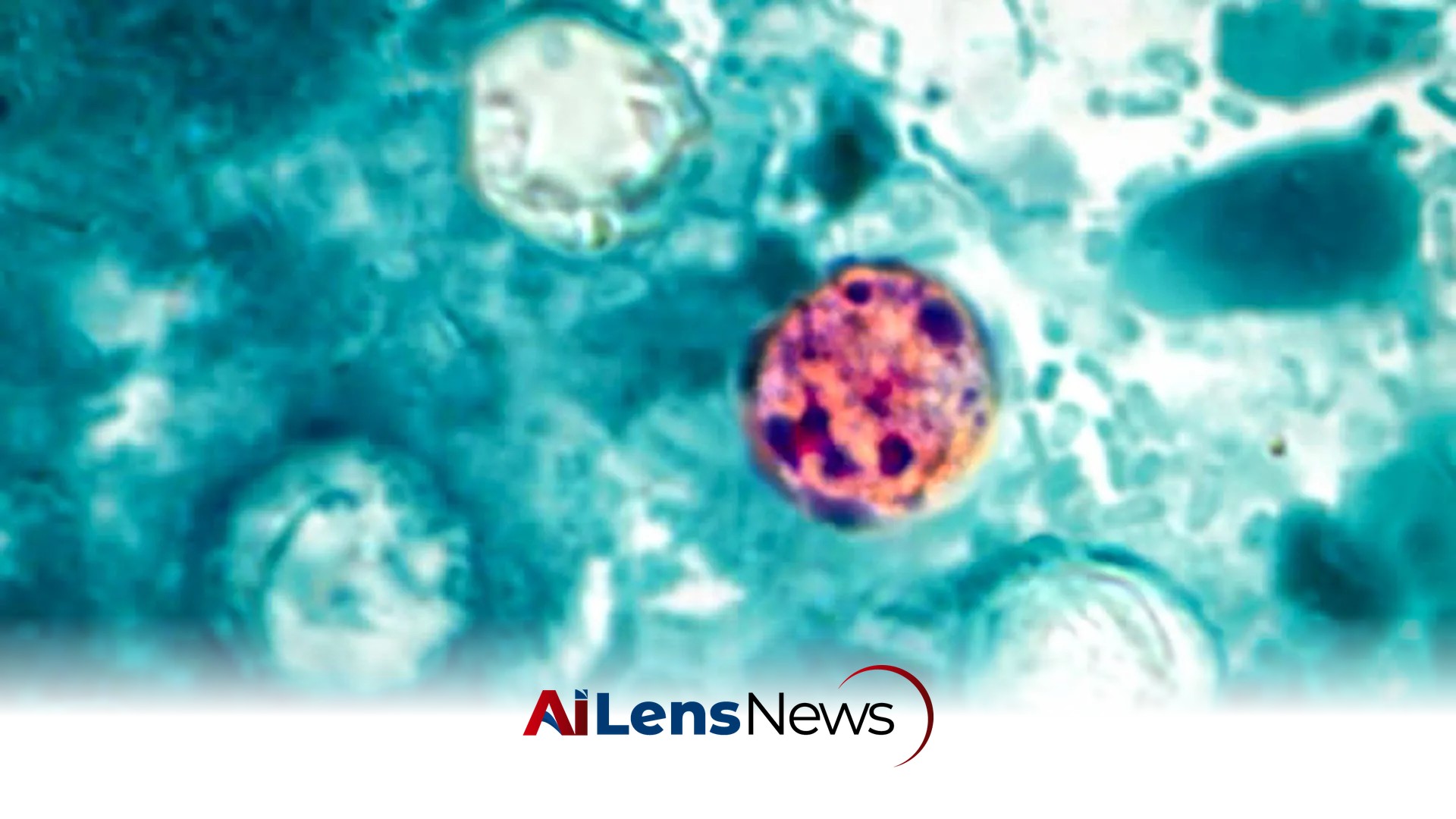 CDC Investigates Cyclospora Outbreak Affecting Over 400 Individuals
