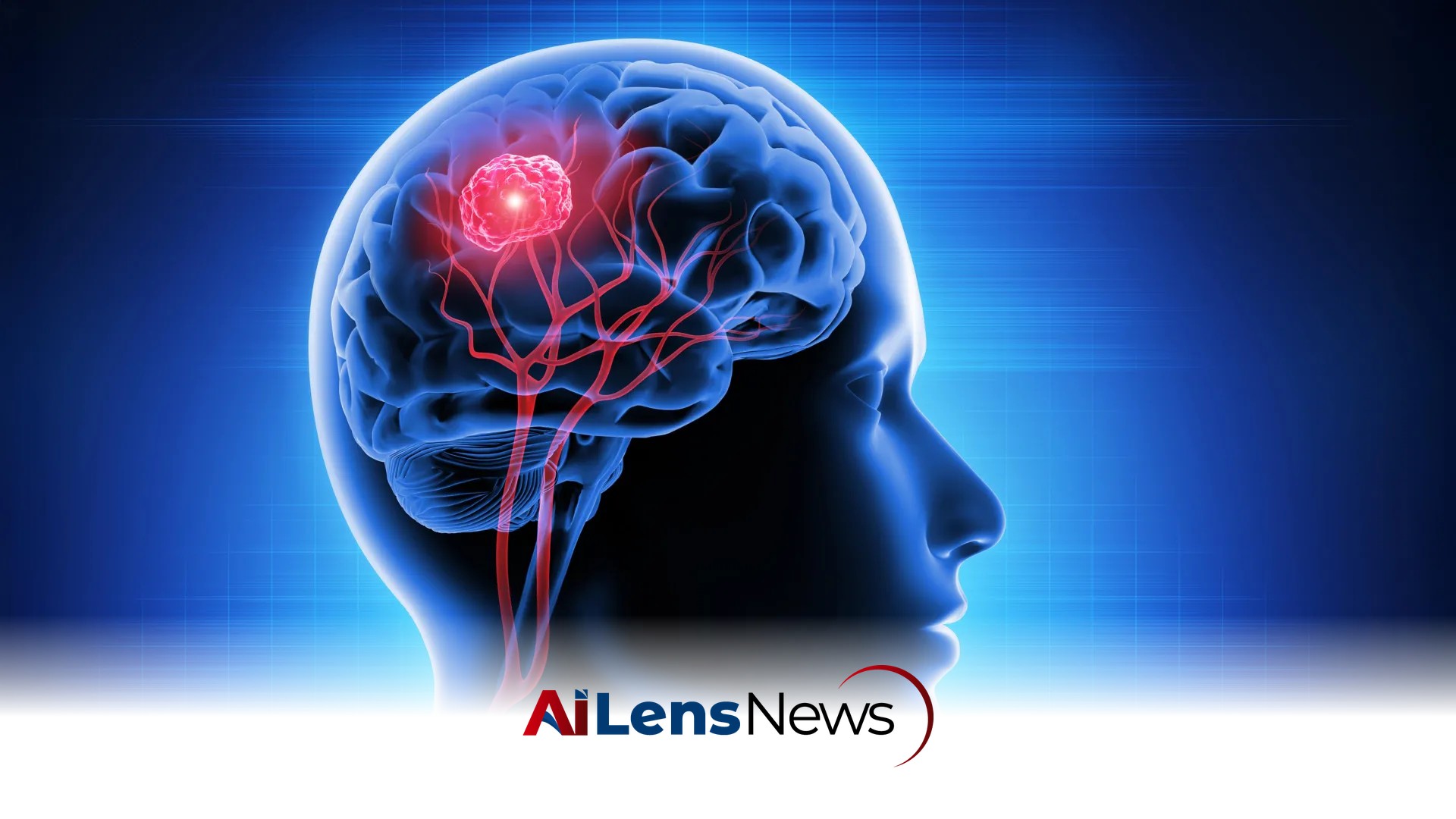 New vitamin B12 therapy shows promise against deadly brain cancer