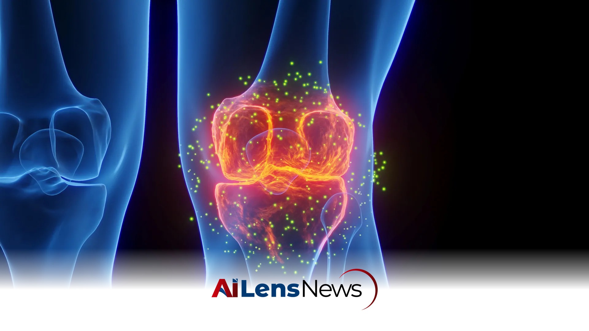 This Emerging Treatment is Helping People Avoid Knee Replacement Surgery