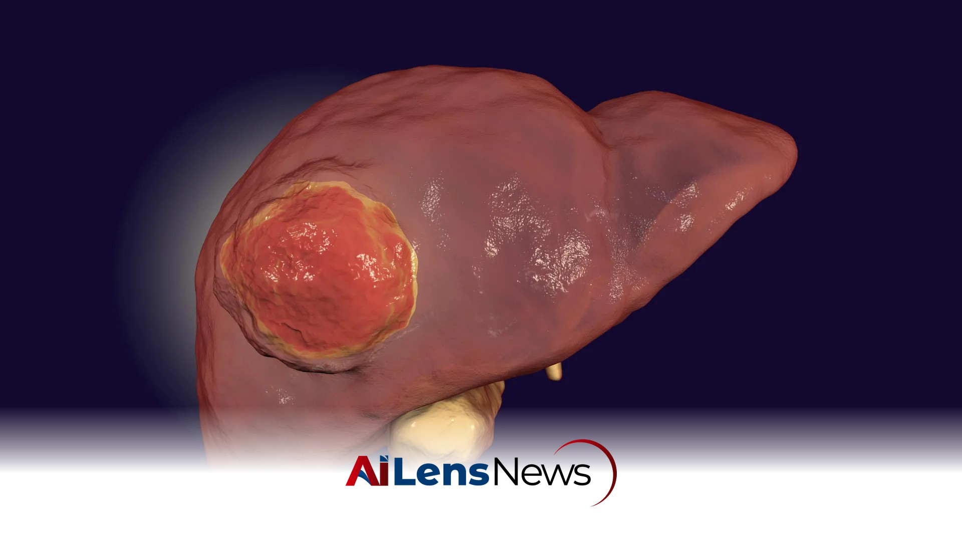 FDA-Approved Drug May Help Immunotherapy Combat Rare Liver Cancer