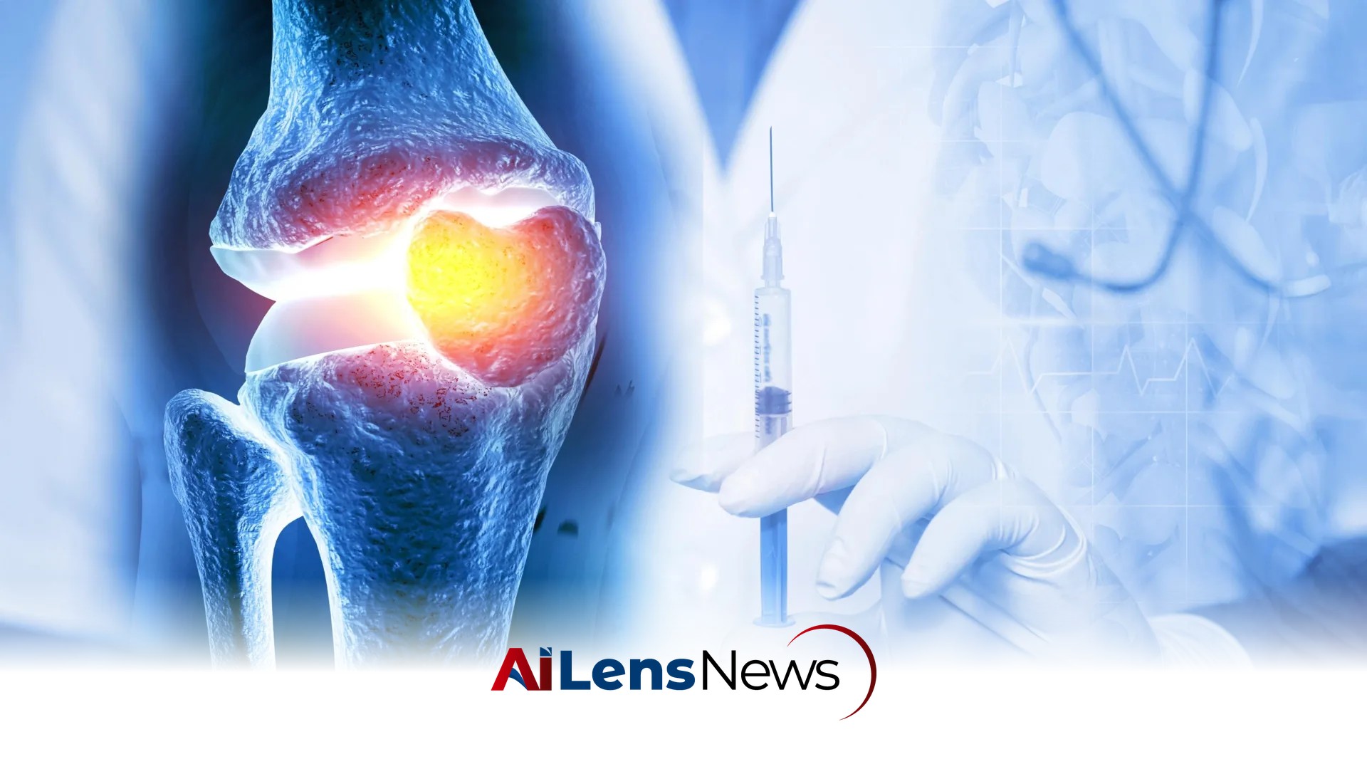 One Injection Reversed Osteoarthritis in Weeks