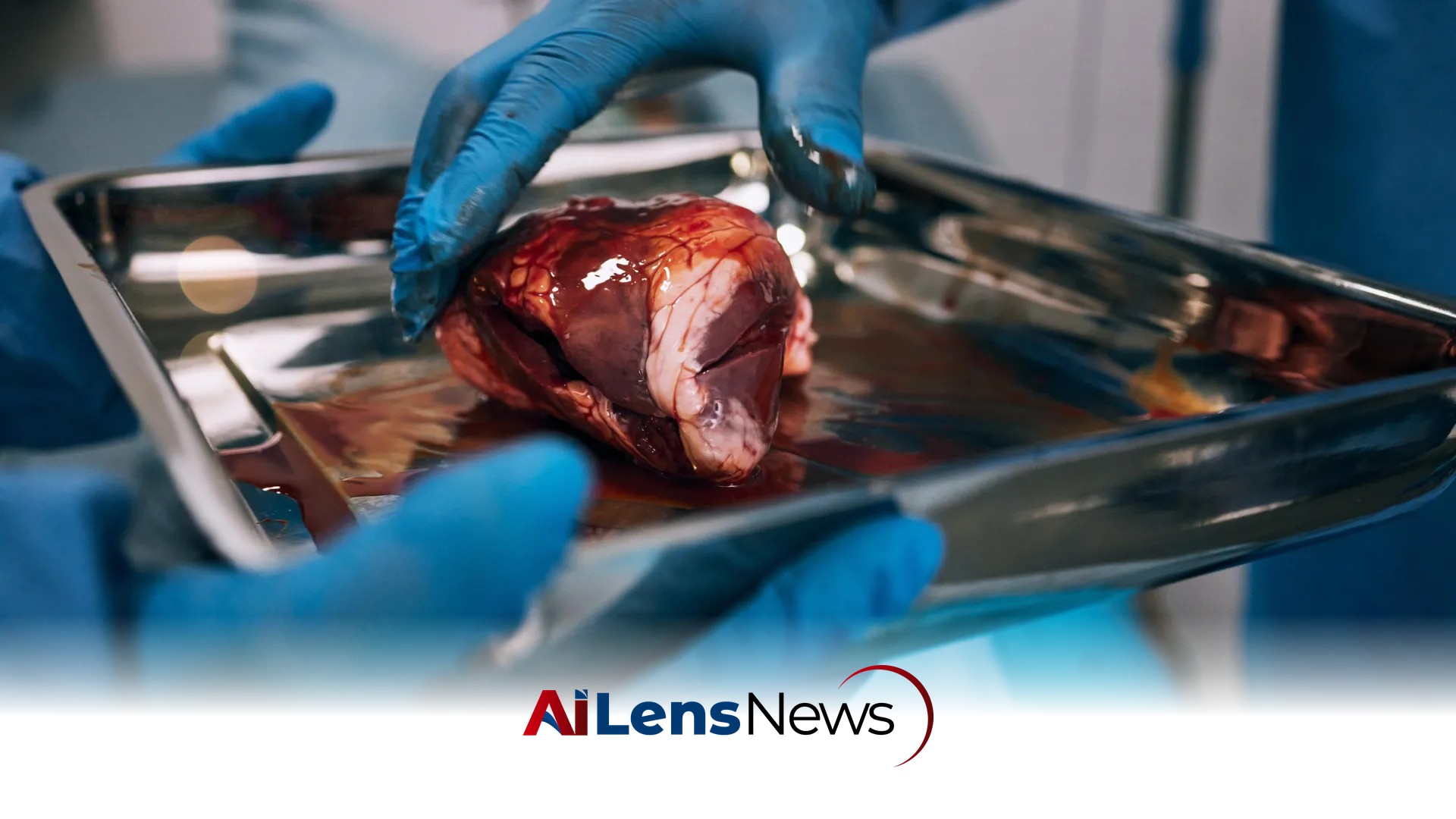 Nearly Half of Kidney Transplant Patients Never Begin Evaluation Process