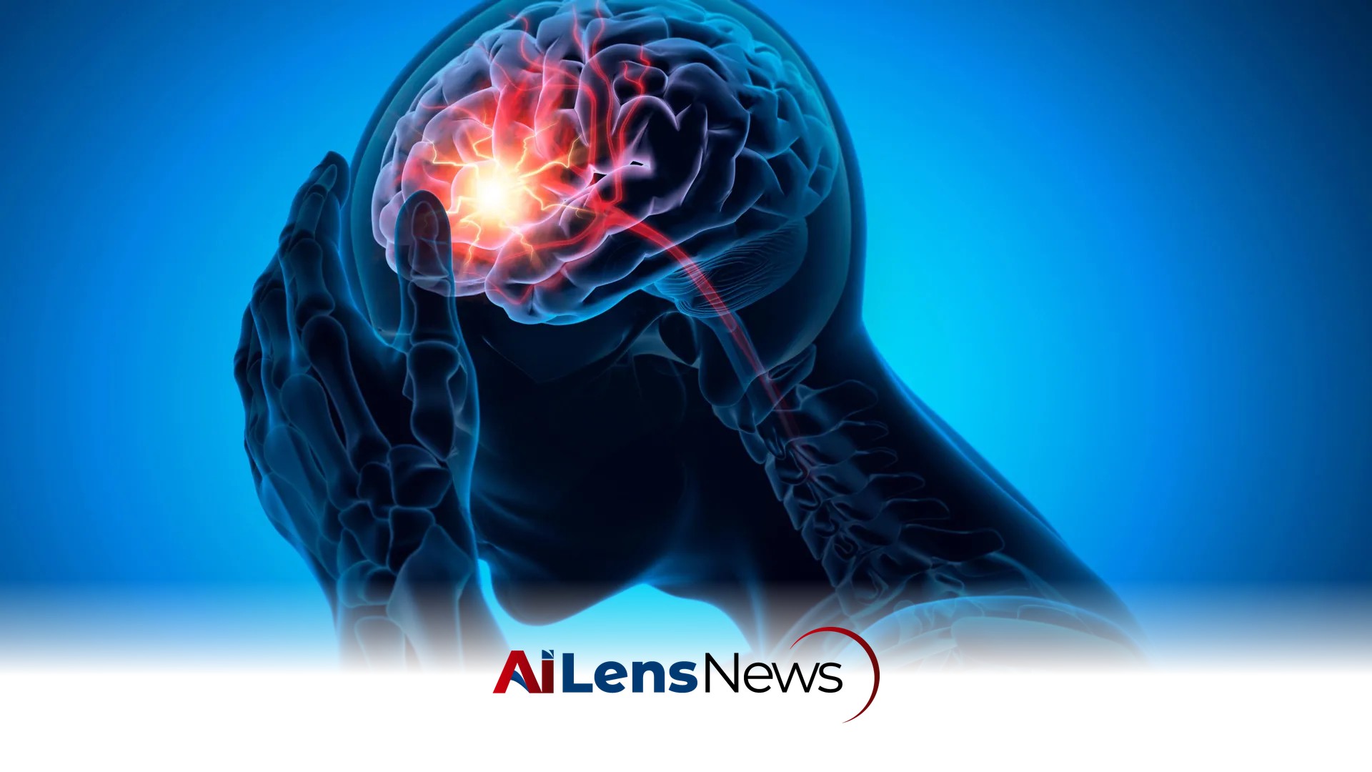 The Real Cause of a Common Stroke May Have Been Missed for Decades